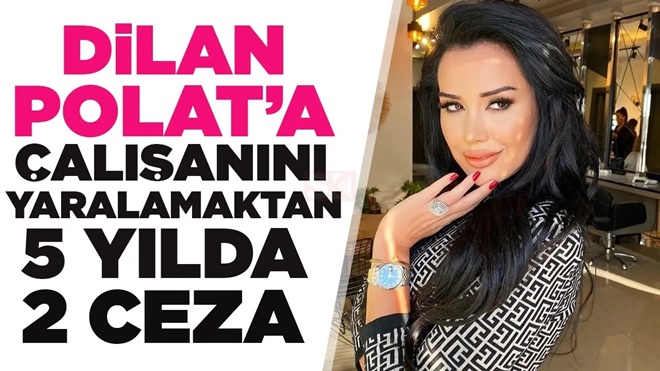 Skandalları Bitmiyor! Dilan Polat Çalışanını Darp Etmiş!