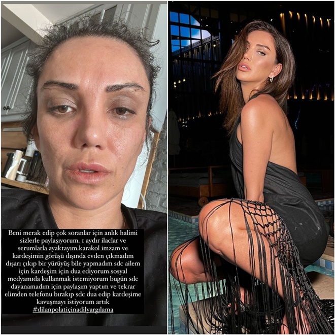 Dilan Polat'ın ablası Sıla Doğu tanınmayacak halde! 