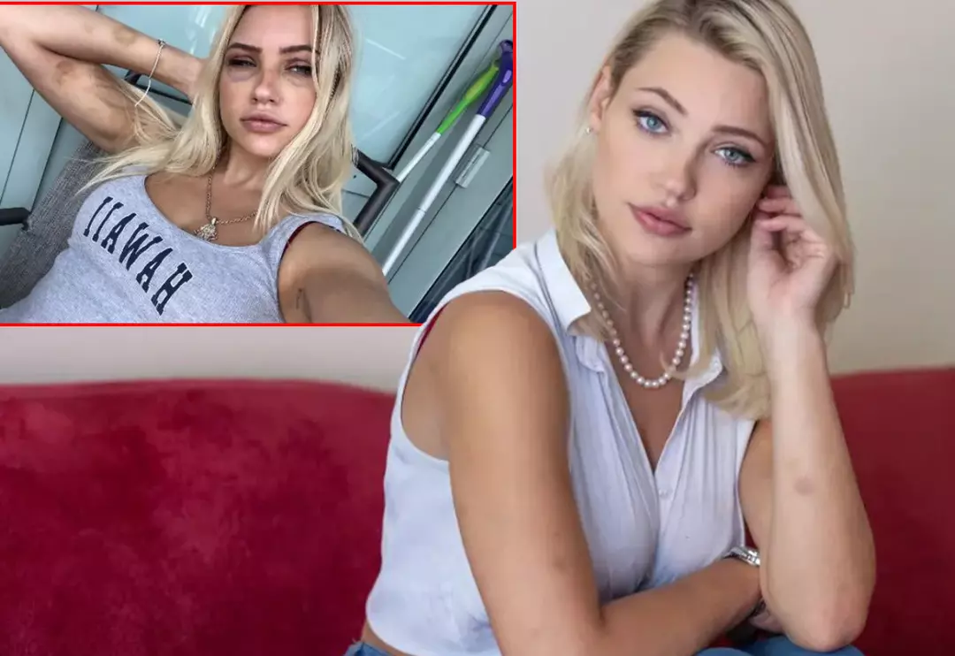 Plastik cerrah sevgilisi tarafından işkenceye uğradı