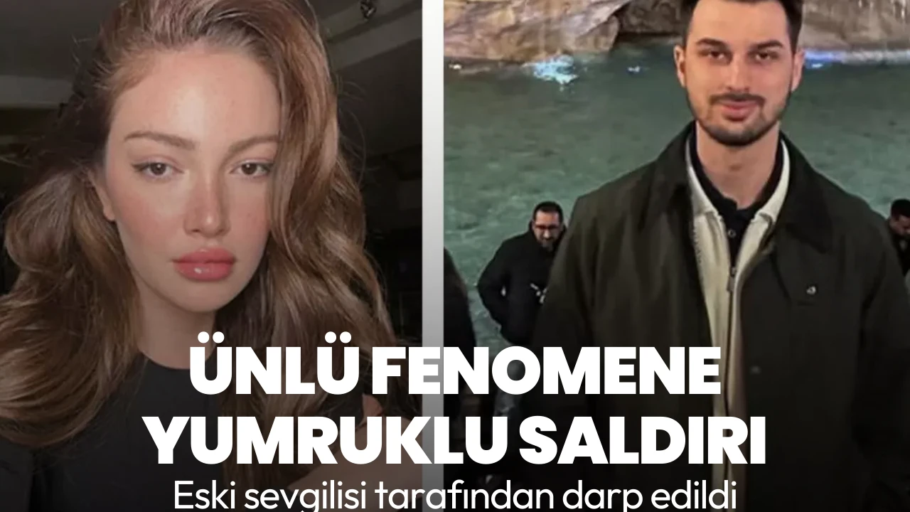 Danla Biliç eski sevgilisi tarafından darbedildi