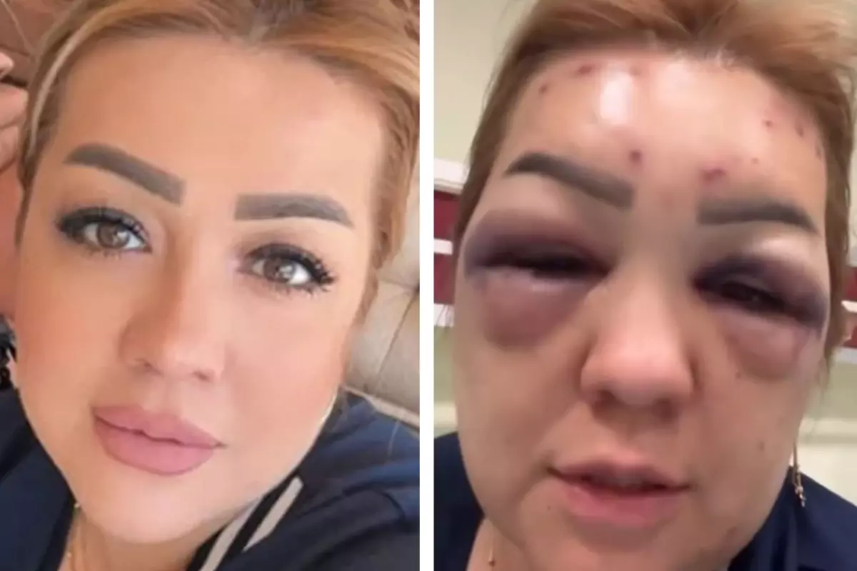 Güzelleşmek için gittiği estetik merkezinde kabusu yaşadı