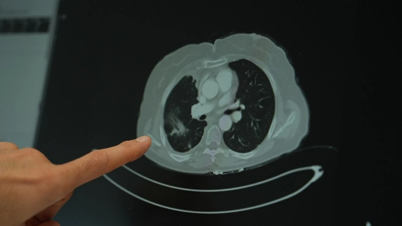 Genç yaş grubunda kanser vakalarında artış yaşanıyor