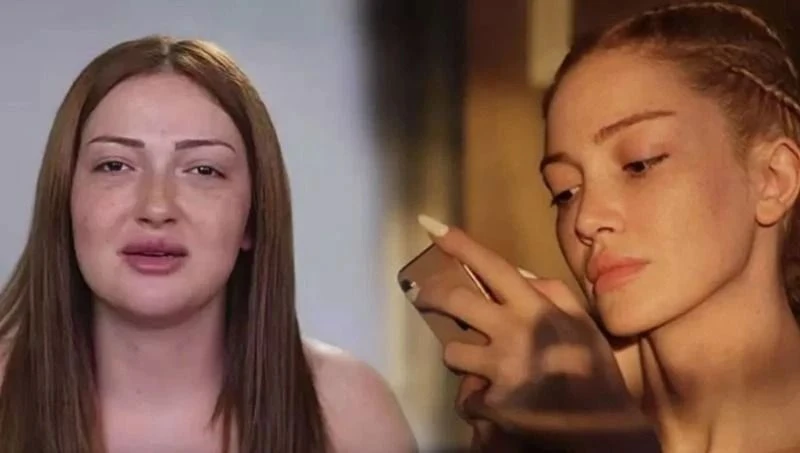 Danla Bilic Bu Kez Boynuyla Gündemde: 12 Milyonluk Estetikten Sonra Yeni Müdahale!