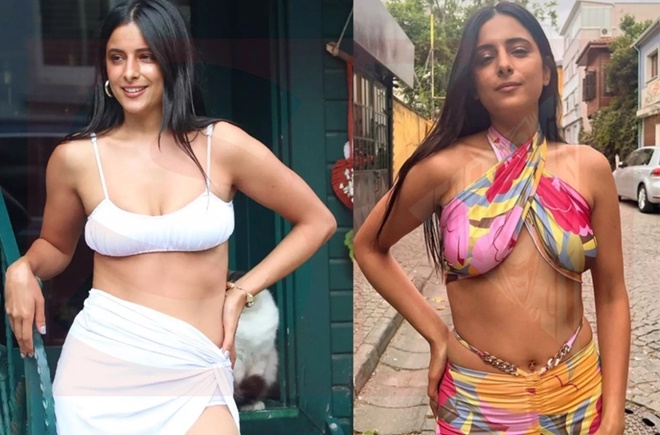 O Ses Türkiye Ayda Mosharraf'ın son hali gündem oldu