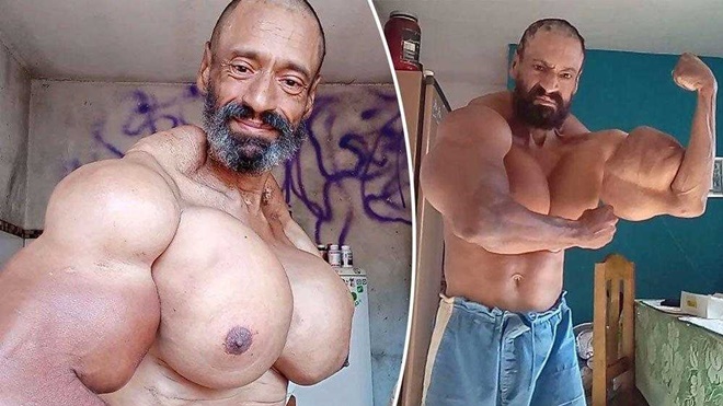 ‘Brezilyalı Hulk’ olarak tanınıyordu, doğum gününde hayatını kaybetti