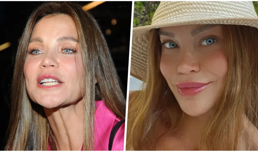 Ebru Şallı'nın yüzündeki şişlik dikkat çekti