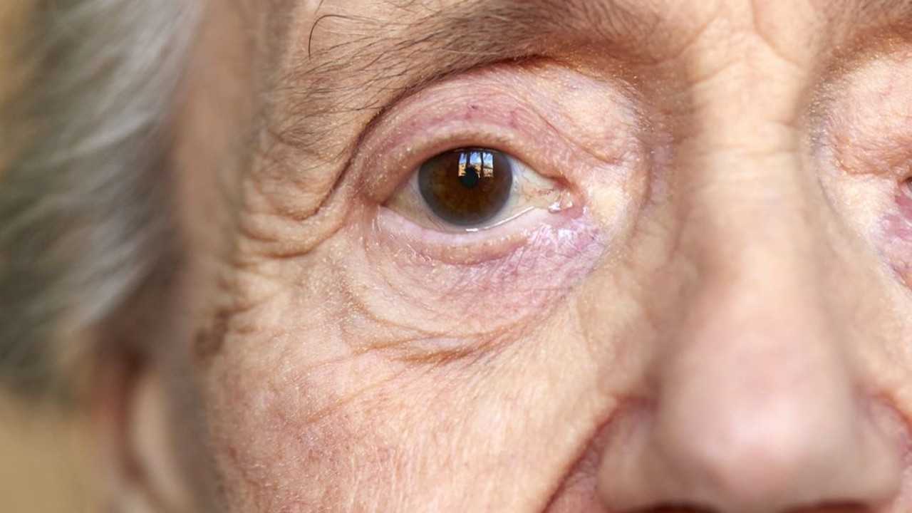 Sağlıklı kolesterol Alzheimer riskini azaltıyor