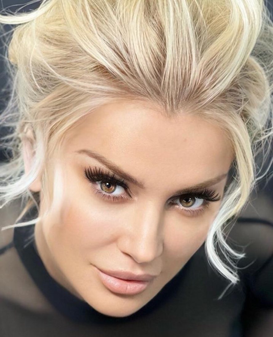 Songül Karlı yine estetik yaptırdı!